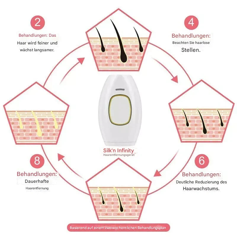GlowSilk IPL-Haarentfernungshandgerät – Glatte Haut zu Hause