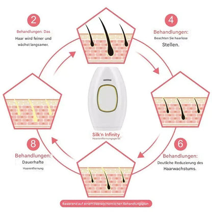 GlowSilk IPL-Haarentfernungshandgerät – Glatte Haut zu Hause